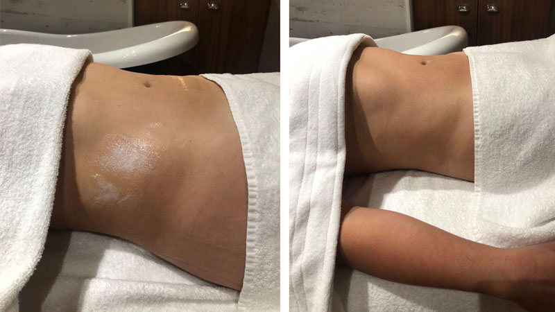 dich-vu-lymphatic-massage-lunariaskinlab