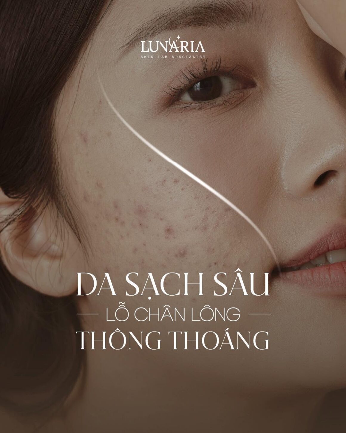 629347379_842793022051655_7825343858210818785_n Spa Nặn Mụn Tại Đà Nẵng: Vì Sao Tự Nặn Mụn Có Thể Khiến Da Tệ Hơn?